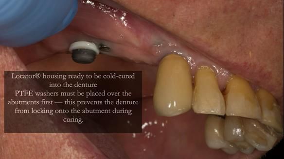 Ken – going downhill, first class