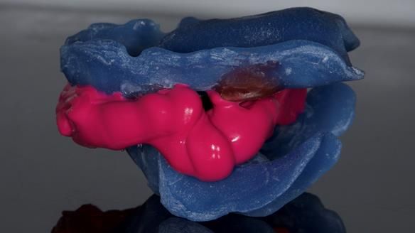 Newsletter 79 – Creating a wonderful smile and changing a life.