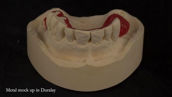 Ken – going downhill, first class