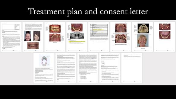 Finlay's Case Study Newsletter 40 - Immediate Mk 1 RPD to Definitive Mk 2 RPD - full protocol
