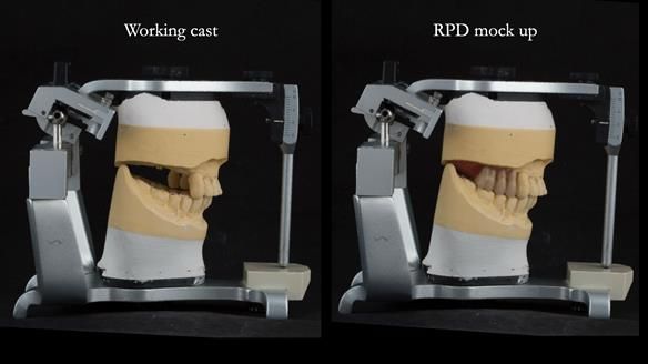 Ken – going downhill, first class