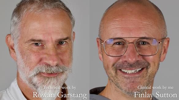 Newsletter 75: Marion’s case - Step-by-step complete denture workflow