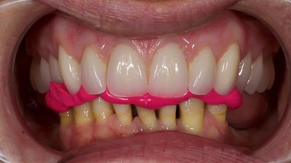 Newsletter 79 – Creating a wonderful smile and changing a life.