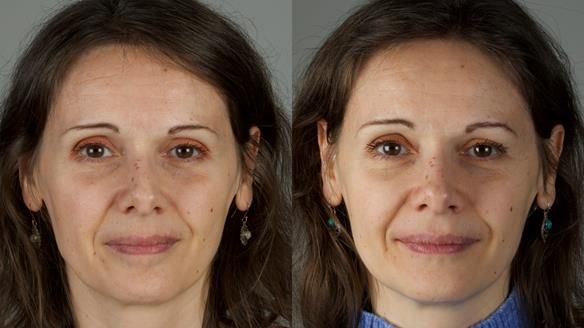 Newsletter 79 – Creating a wonderful smile and changing a life.