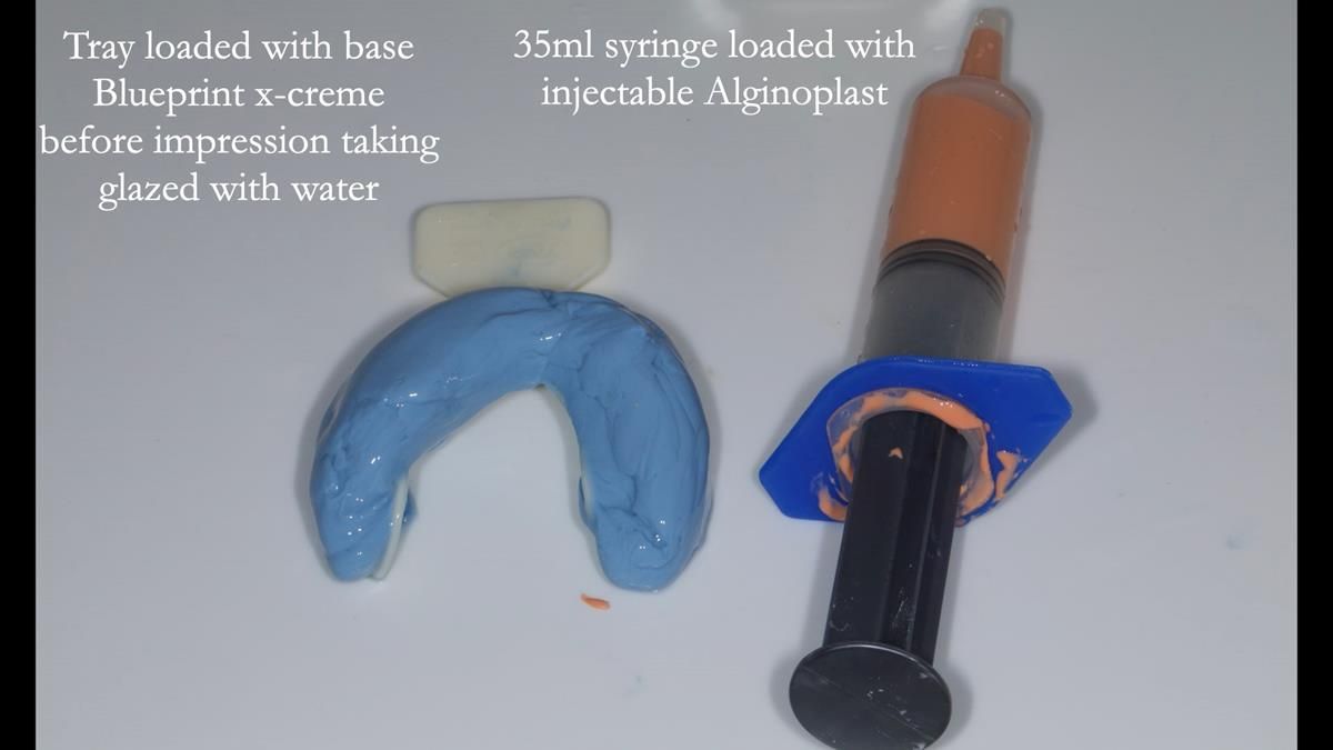 Fin’s Newsletter 88 — Complete dentures - full protocol… he rearranged his own teeth!