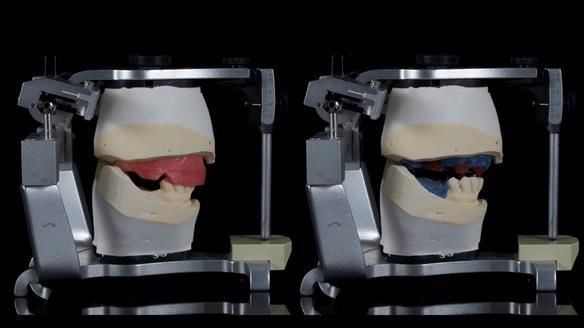 Newsletter 79 – Creating a wonderful smile and changing a life.