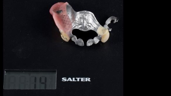 Newsletter 86 Peter the Architect — precision removable partial dentures case study