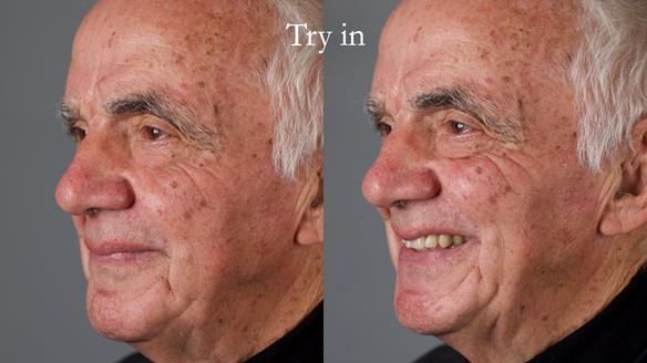 Newsletter 74: Ken’s Case Study Complete Dentures - Life Like and Age Appropriate