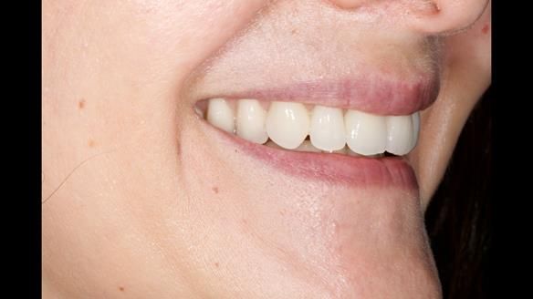 Newsletter 79 – Creating a wonderful smile and changing a life.