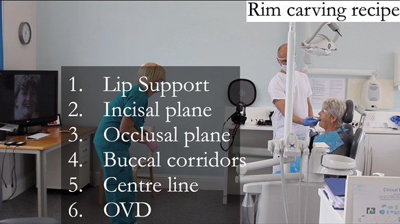 Figure 66 The upper rim is prescribed in this order