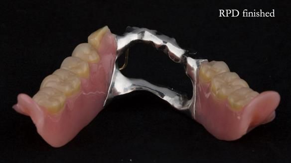 Ken – going downhill, first class