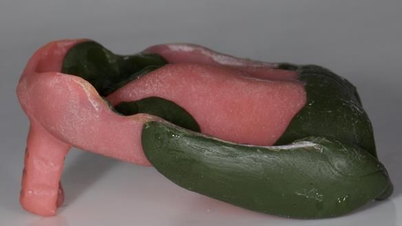 Newsletter 79 – Creating a wonderful smile and changing a life.