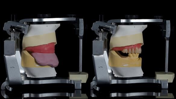 Newsletter 79 – Creating a wonderful smile and changing a life.