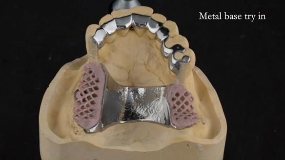 Ken – going downhill, first class