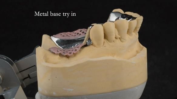 Ken – going downhill, first class