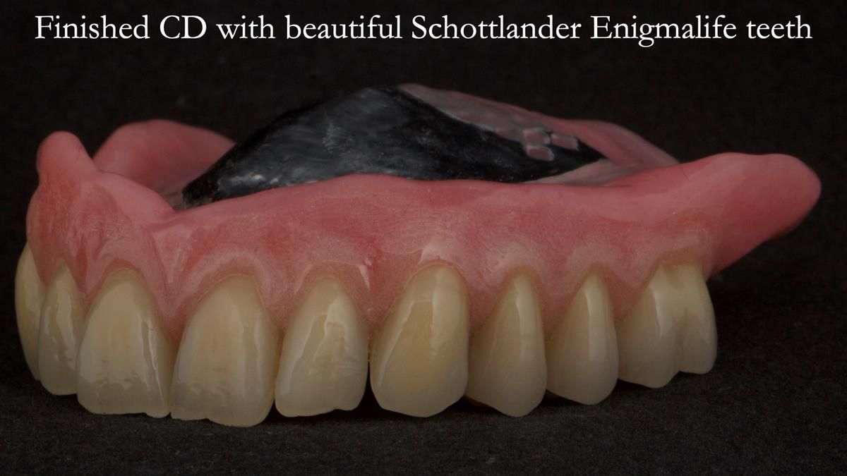 Newsletter 87 – Father Peter: A Partial Denture that needed Minor Miracle
