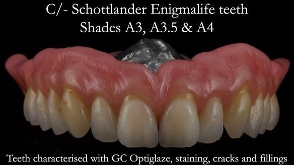 Newsletter 50 Special edition Complete Dentures FULL PROTOCOL