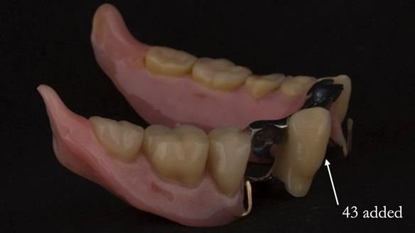 Ken – going downhill, first class