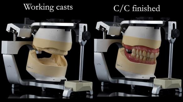 Newsletter 50 Special edition Complete Dentures FULL PROTOCOL