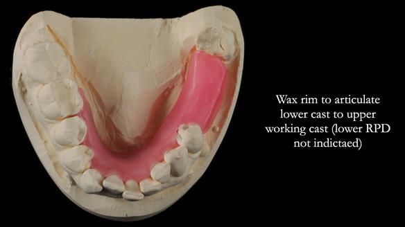 Finlay's Newsletter 60 Sylvia's upper Kennedy Class 2 Mod 1 metal based upper RPD