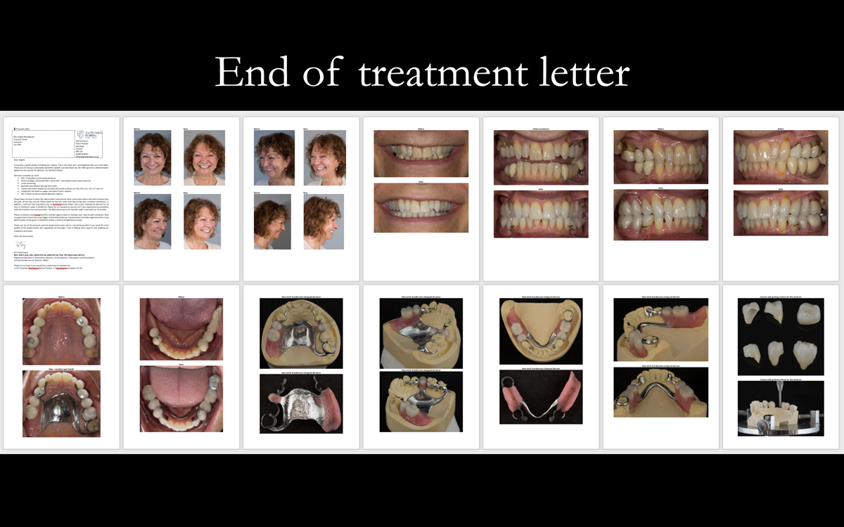 Finlay's fixed and removable prosthodontic case presentation of crowns and partial dentures