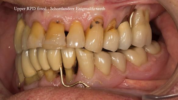 Ken – going downhill, first class