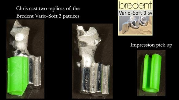 Newsletter 76: Jackie’s case – Telescopic overdenture & precision RPD (the tricky truth!)