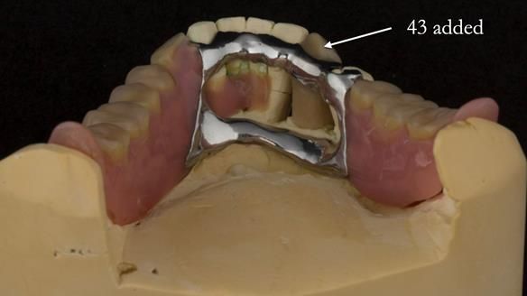 Ken – going downhill, first class