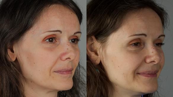 Newsletter 79 – Creating a wonderful smile and changing a life.