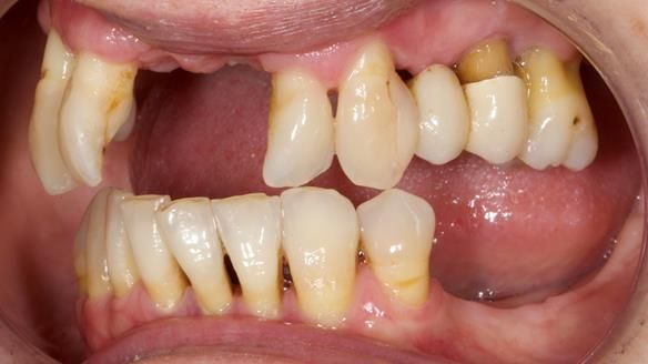 Newsletter 79 – Creating a wonderful smile and changing a life.