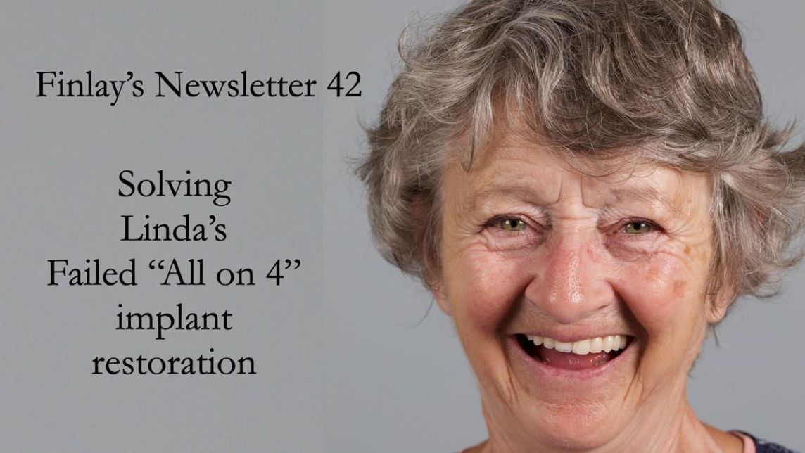 Solving Linda’s Failed “All on 4” implant bridges - full protocol Newsletter 42