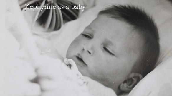 Newsletter 55 Provision of metal based partial dentures for Zephyrine with a repaired cleft lip and palate