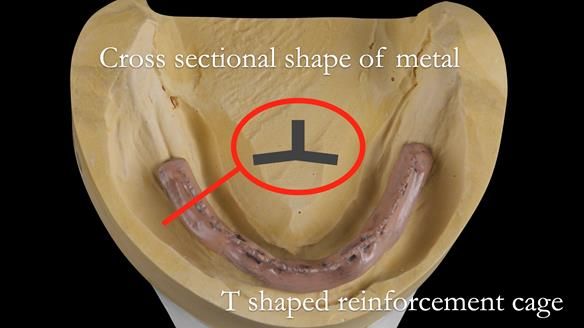 Newsletter 50 Special edition Complete Dentures FULL PROTOCOL