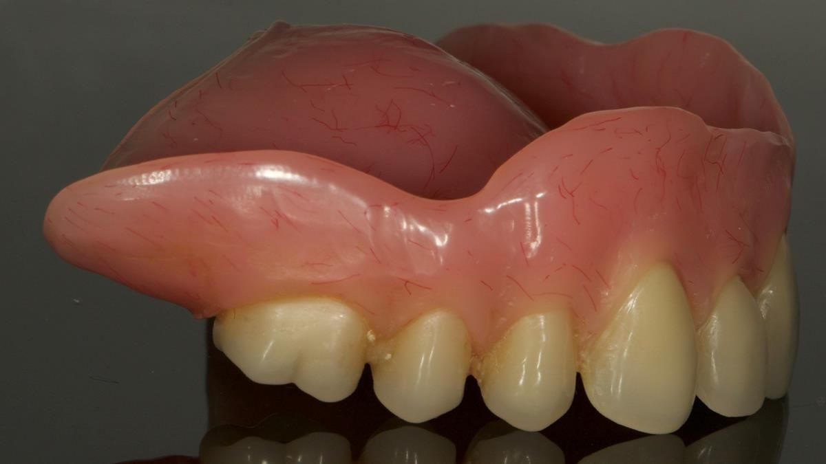 Newsletter 87 – Father Peter: A Partial Denture that needed Minor Miracle
