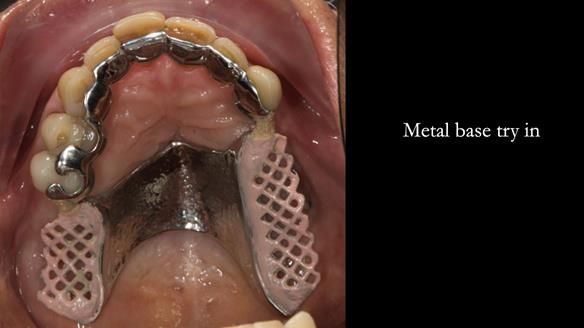 Ken – going downhill, first class