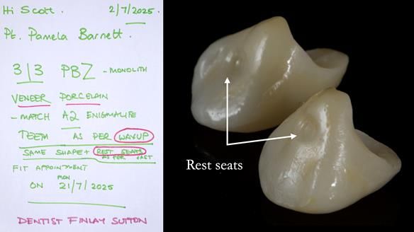 Newsletter 81 - Pam’s Story — how a partial denture changed her life (+ live walkthrough this Thursday)