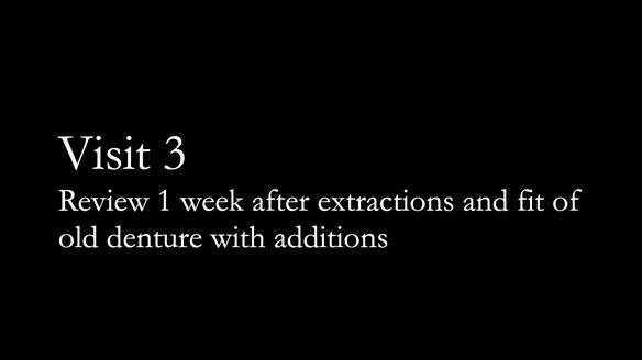 Finlay's Newsletter 62 provision of extractions and metal based complete dentures for Rafique