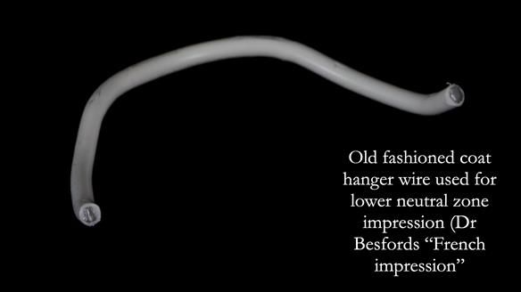 Newsletter 83: Sheila’s Complete Denture Success