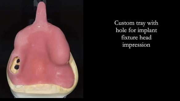 Ken – going downhill, first class