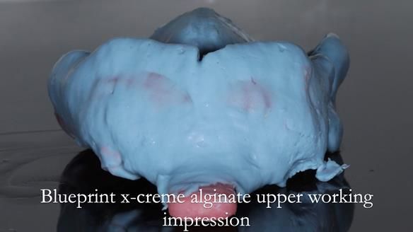 Finlay's Newsletter 60 Sylvia's upper Kennedy Class 2 Mod 1 metal based upper RPD