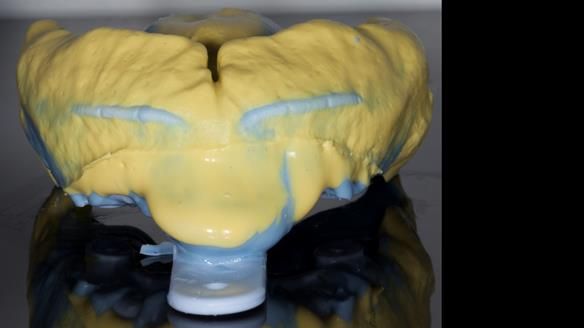 Newsletter 79 – Creating a wonderful smile and changing a life.