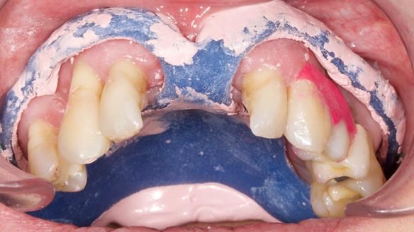 Newsletter 79 – Creating a wonderful smile and changing a life.