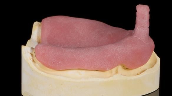 Newsletter 79 – Creating a wonderful smile and changing a life.