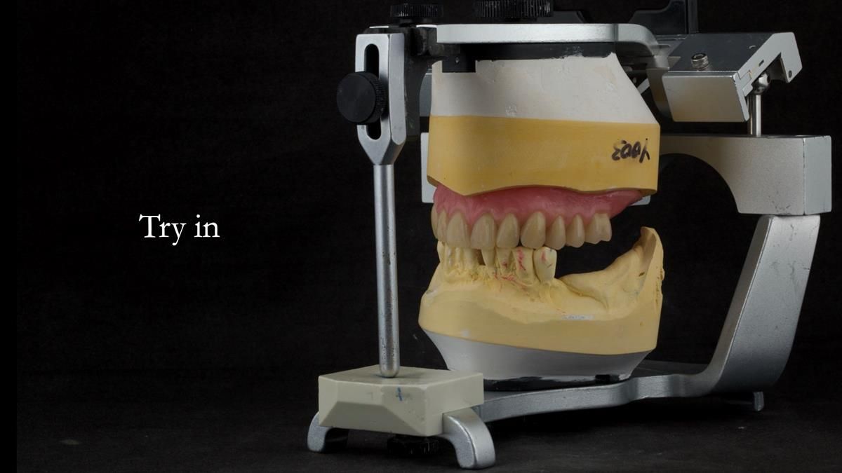Newsletter 87 – Father Peter: A Partial Denture that needed Minor Miracle
