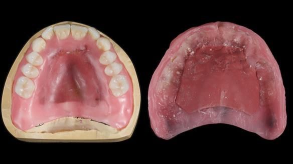 Newsletter 79 – Creating a wonderful smile and changing a life.