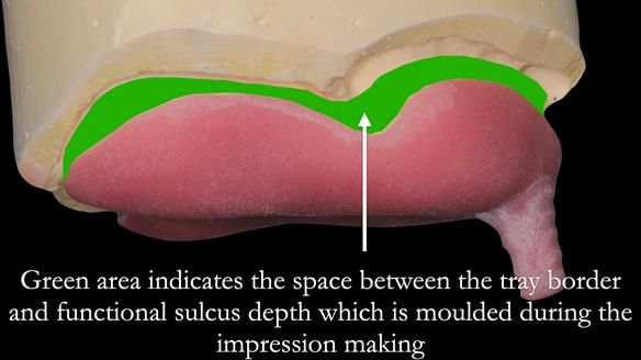 Newsletter 50 Special edition Complete Dentures FULL PROTOCOL