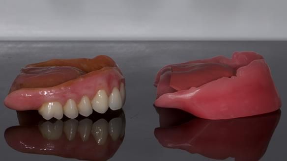 Newsletter 79 – Creating a wonderful smile and changing a life.