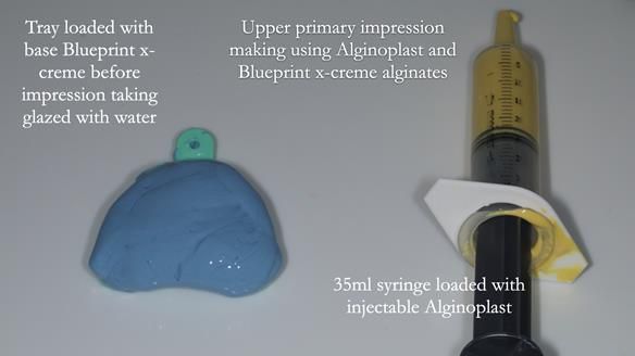 Newsletter 83: Sheila’s Complete Denture Success