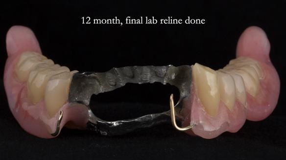 Ken – going downhill, first class