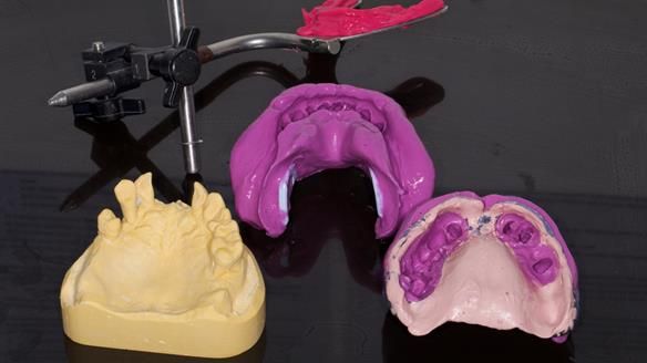 Newsletter 79 – Creating a wonderful smile and changing a life.